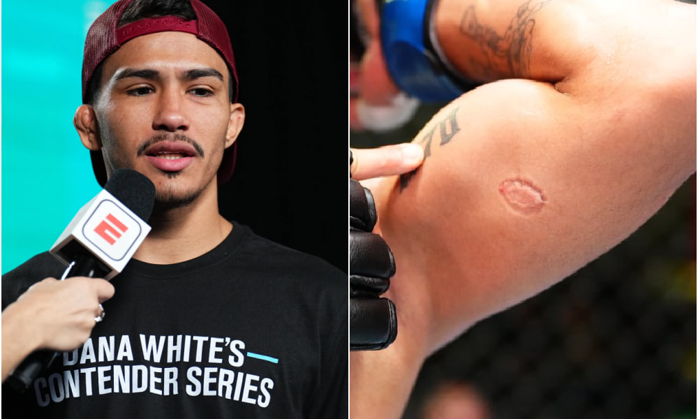 Igor Severino Disqualified for Biting Andre Lima at UFC Vegas 89: Dana White Awards ‘Bite of the Night’ Bonus