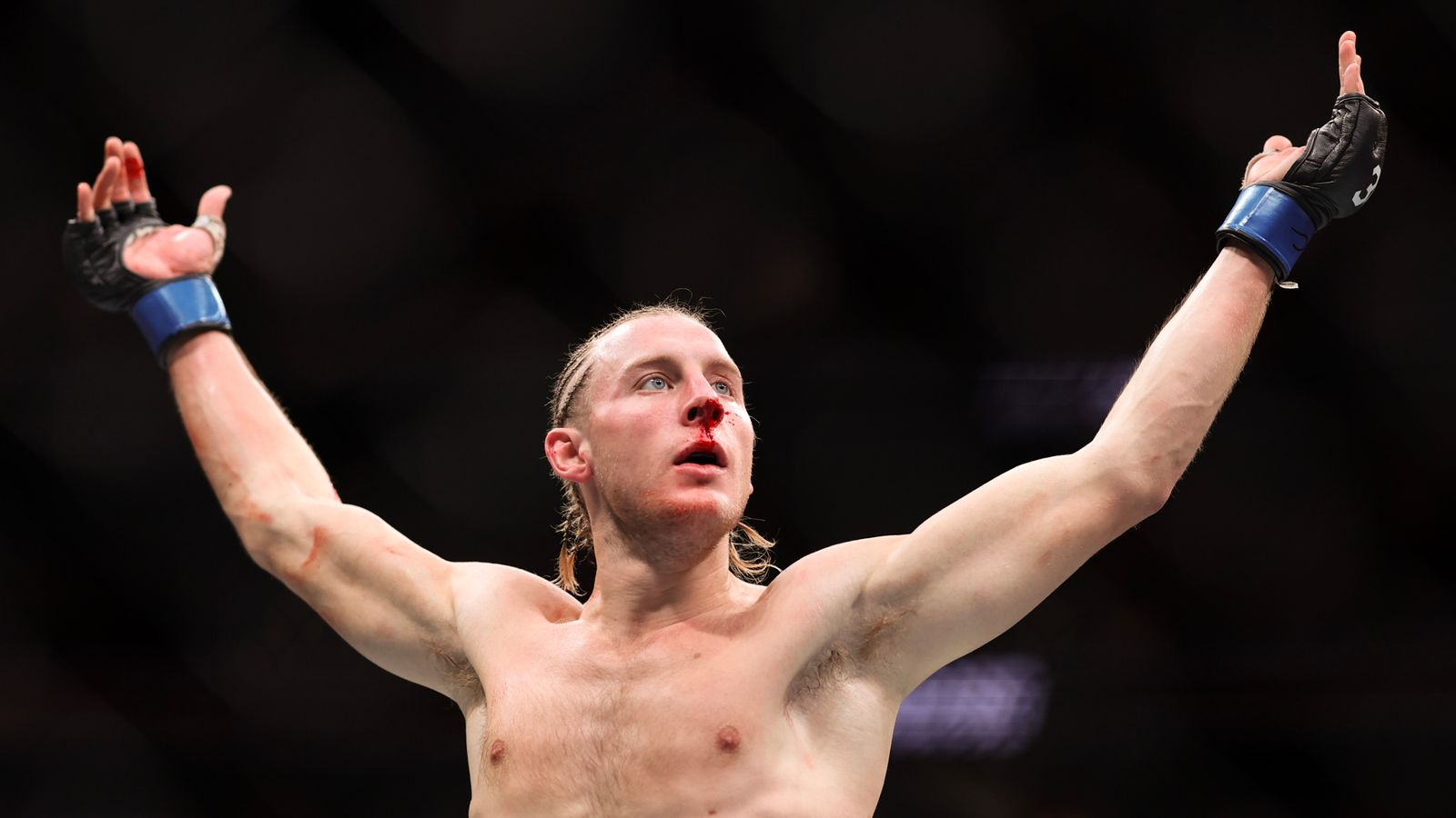 Paddy Pimblett Opens Up About Mental Health Struggles Ahead of UFC 304